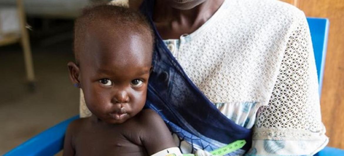 दक्षिण सूडान के जुबा में अल सब्बाह चिल्ड्रन्स हॉस्पिटल में अफरा, उसकी मां थेरेसी द्वारा आयोजित कुपोषण के लिए जाँच की जा रही है