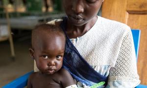Afra, held by her mother Therese, is being checked for malnourishment at Al Sabbah Children's hospital in Juba, South Sudan.