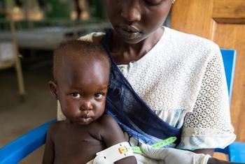 Afra, sostenida por su madre Therese, es examinada por desnutrición en el hospital infantil Al Sabbah en Juba, Sudán del Sur.