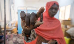 A mother holds the bullet that was removed from her eight-year-old daughter after she was hit at her home on the outskirts of capital Khartoum. 