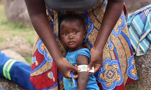 A child in Zimbabwe is checked for malnutrition.