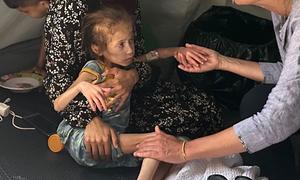 La hambruna asola a la población de Gaza mientras Israel continúa impidiendo la entrada a gran escala de ayuda humanitaria.