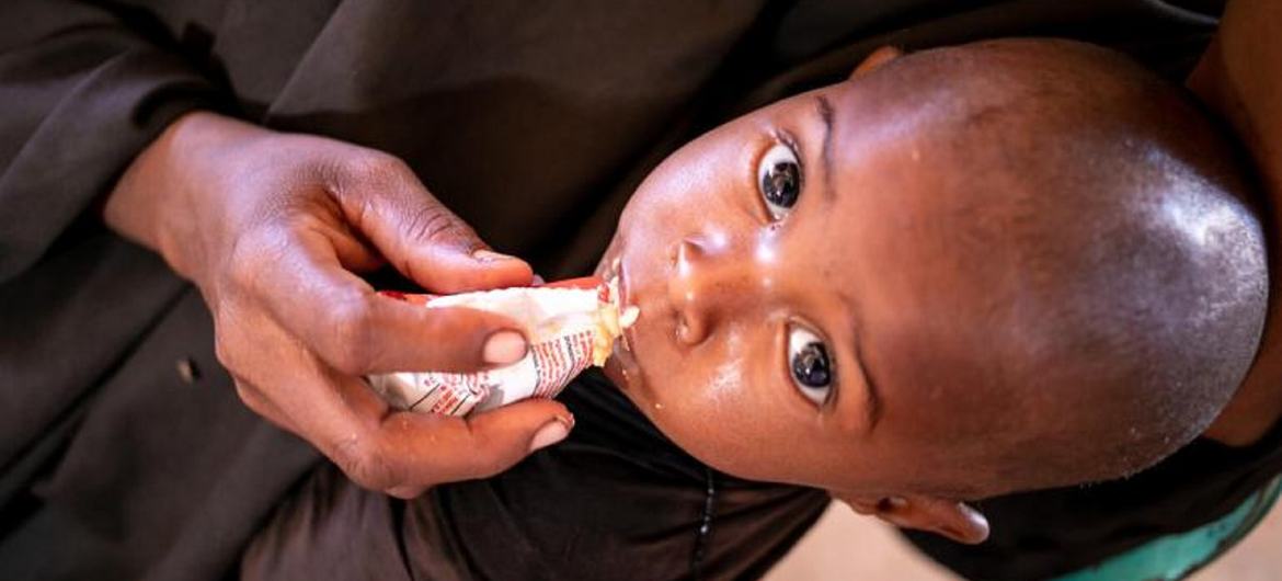 UNICEF Somalia provides nutritional intervention services to malnourished children.