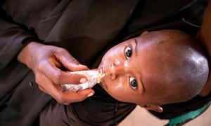 UNICEF Somalia provides nutritional intervention services to malnourished children.