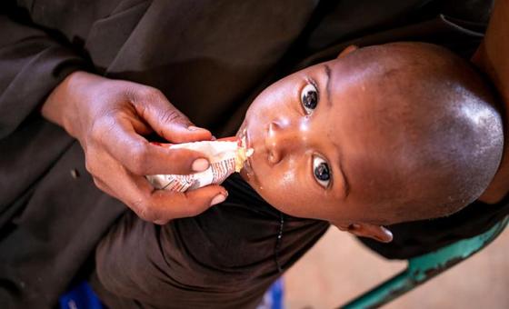 Somalia: UNICEF memperingatkan kematian anak yang belum pernah terjadi sebelumnya |