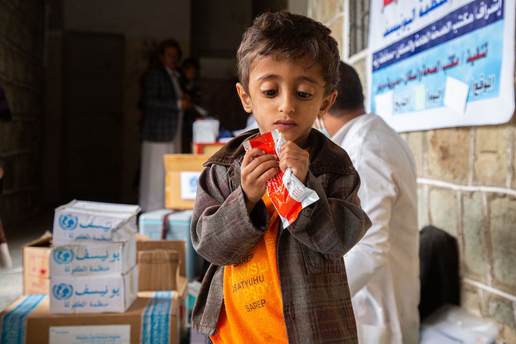 Un enfant dénutri dans un centre d'alimentation thérapeutique au Yémen
