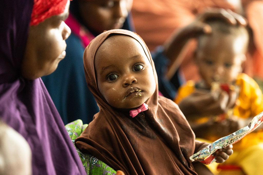 Un niño recibe tratamiento contra la desnutrición en un centro apoyado por UNICEF en  Dollow, Somalia.