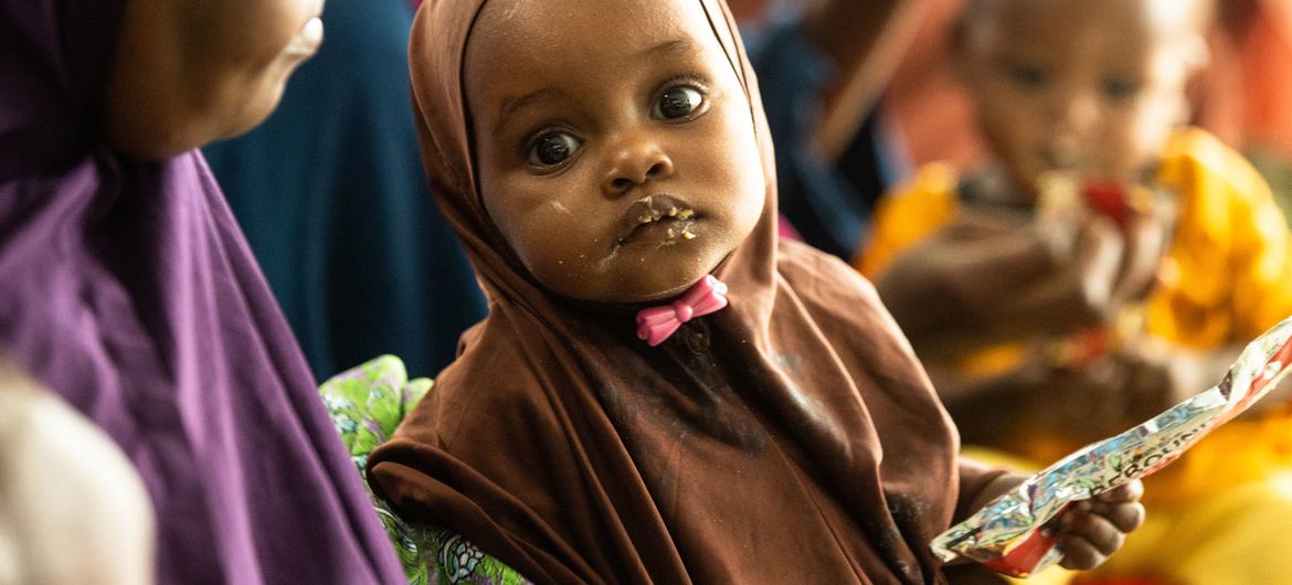 Un enfant reçoit un traitement contre la malnutrition dans un centre soutenu par l'UNICEF à Dollow, en Somalie.