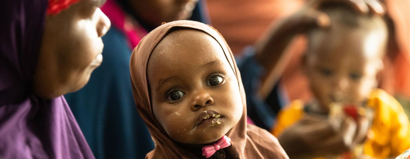 Un enfant reçoit un traitement contre la malnutrition dans un centre soutenu par l'UNICEF à Dollow, en Somalie.