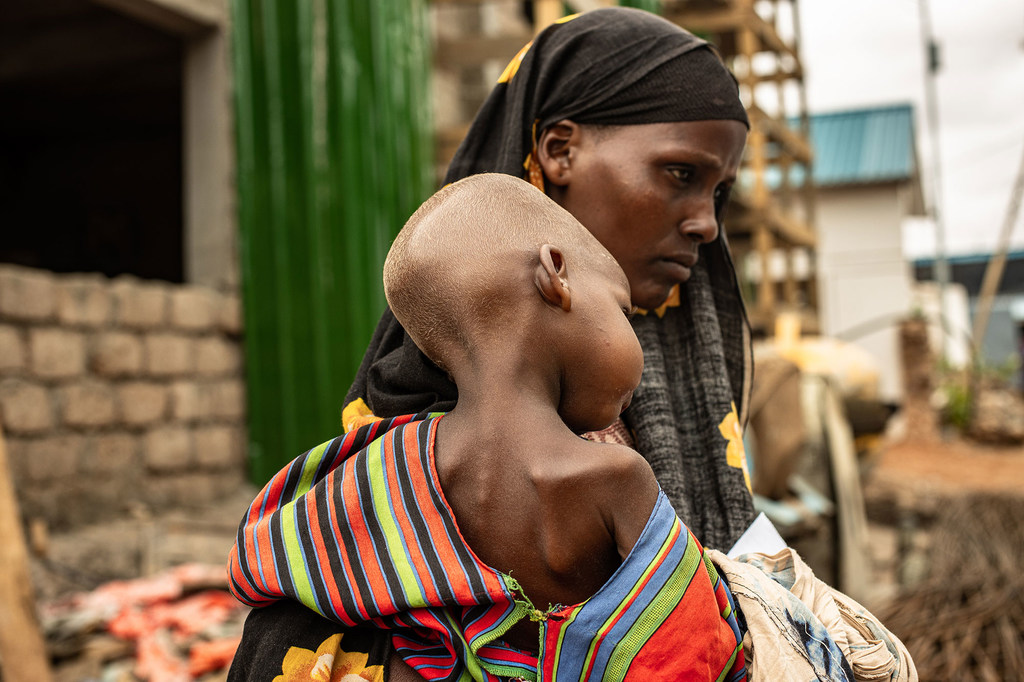 Una madre carga a su hijo desnutrido.