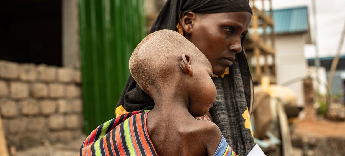 सोमालिया में एक महिला, अपने कुपोषित बच्चे के साथ.