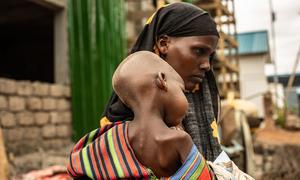 A mother holds her malnourished child in Dollow, Somalia.