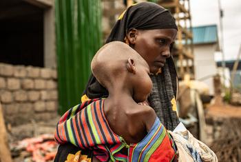 A mother holds her malnourished child in Dollow, Somalia.