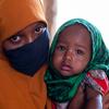 Mère et enfant au centre de santé pour la malnutrition, Somalie
