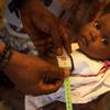 طفل صغير يخضع للفحص للكشف عن سوء التغذية في سيتي سولاي، هايتي.