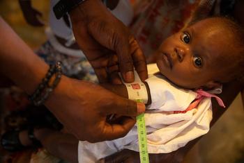 طفل صغير يخضع للفحص للكشف عن سوء التغذية في سيتي سولاي، هايتي.