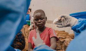 Msichana mgonjwa anapokea matibabu katika kituo cha kutenga na kutibu wagonjwa wa mpox kinachosaidiwa na UNICEF katika Hospitali ya Kavumu, jimbo la Kivu Kusini, Jamhuri ya Kidemokrasia ya Kongo, tarehe 10 Septemba 2024. 