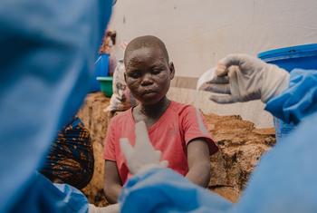 Um jovem paciente recebe tratamento na unidade de isolamento de mpox apoiada pelo Unicef no Hospital Kavumu, na província de Kivu do Sul, República Democrática do Congo.