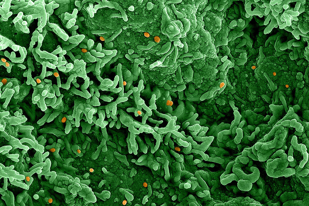 Imagen de microscopía electrónica de barrido coloreada del virus mpox en la superficie de células VERO E6 infectadas. La imagen fue capturada en el Instituto Nacional de Alergias y Enfermedades Infecciosas, Centro Integrado de Investigación, en Fort Detrick, Maryland.