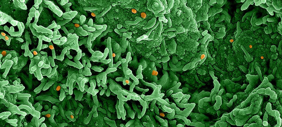 O vírus mpox (laranja) infecta células mostradas em verde