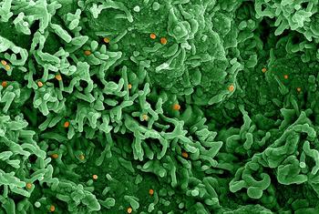 Le virus du mpox (orange) infecte des cellules qui apparaissent en vert.