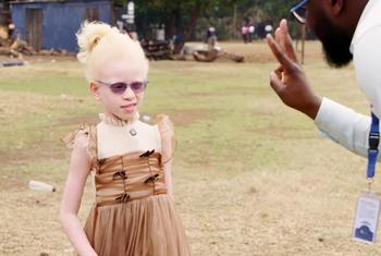 Candy, uma criança de 7 anos no Quênia que luta contra o albinismo