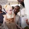 Mtoto mwenye umri wa miaka 7 mwenye ulemavu wa ngozi, anayeitwa Candy, ameketi kwenye hafla nchini Kenya kwa ajili ya watoto wenye ulemavu, kama sehemu ya mpango wa UNICEF . Amevaa gauni la beige na kahawia na miwani ya jua, huku wanaume wawili wakiwa wamesimama kando yake.
