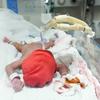 ग़ाज़ा के अल शिफ़ा अस्पताल में, एक बच्चे का उपचार (फ़ाइल)
