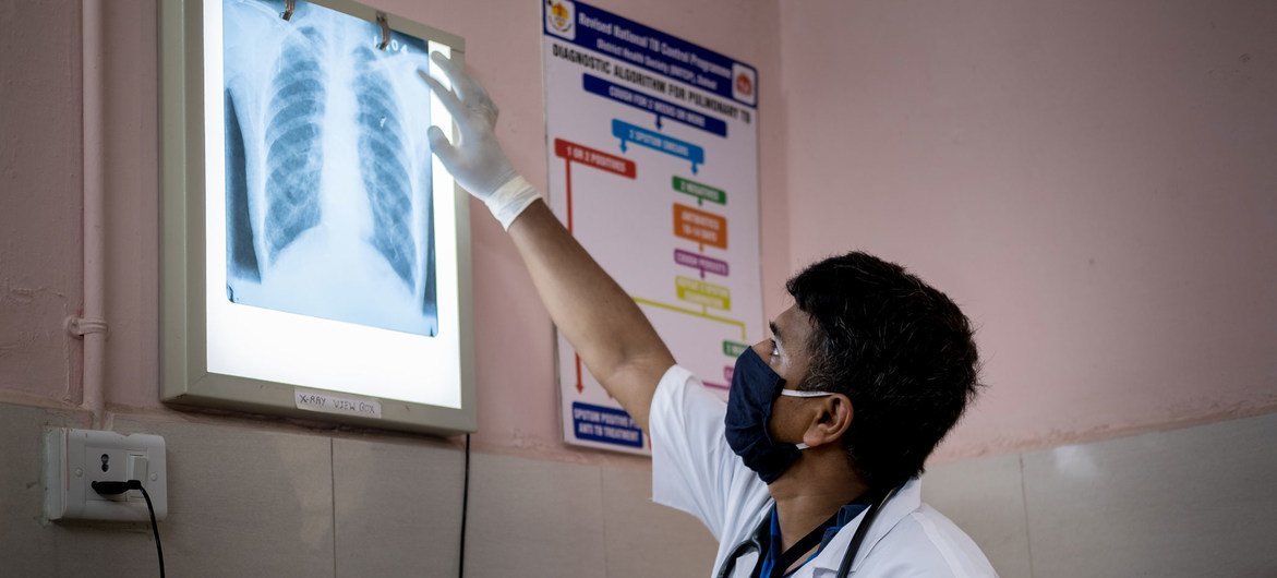 印度古吉拉特邦的一名医生在检查病人的胸片，看是否有肺结核或其他肺部感染的迹象。
