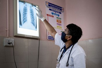 印度古吉拉特邦的一名医生正在检查患者的胸部 X 光片。