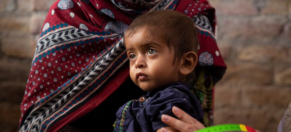 पाकिस्तान के बाढ़ प्रभावित इलाक़े में, कुपोषण के शिकार एक बच्चे की चिकित्सा जाँच.