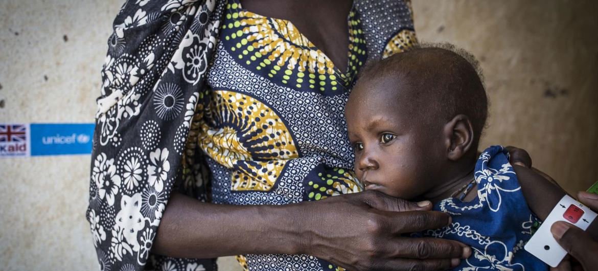Over 15% of the children suffer from acute malnutrition in Timbuktu, Mali.