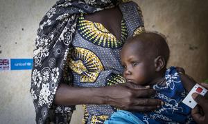 Over 15% of the children suffer from acute malnutrition in Timbuktu, Mali.