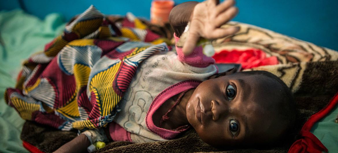 Un nourrisson de sept mois est soigné pour malnutrition aiguë sévère dans un hôpital régional de Tombouctou, au Mali.