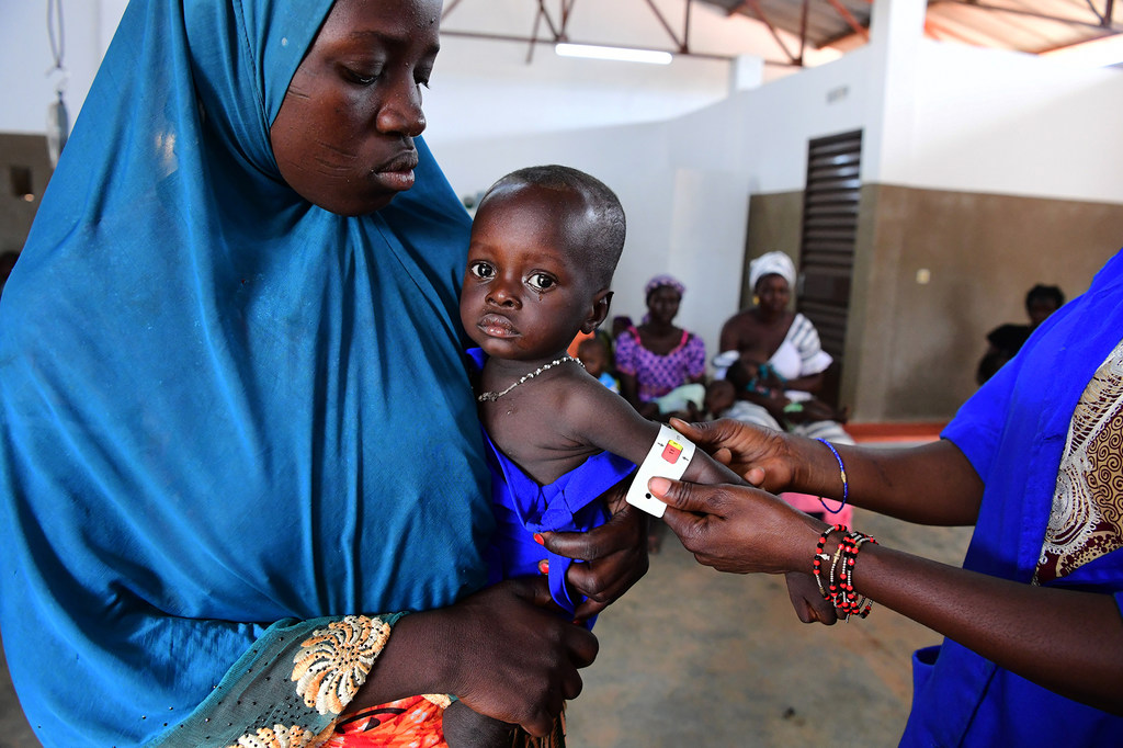 Un enfant examiné pour malnutrition dans un centre de santé à Kaya, au nord du Burkina Faso.