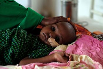 A child recovers from severe malnutrition at a clinic in Burao, Somalia.