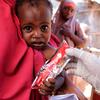 С августа в больницы Сомали поступило более 44 тыс. детей с диагнозом «недоедание».