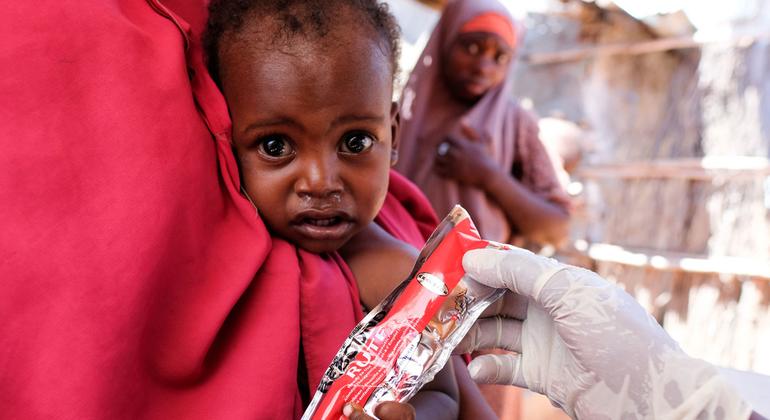 Un niño de año y medio recibe trabamiento por desnutrición en Somalia.