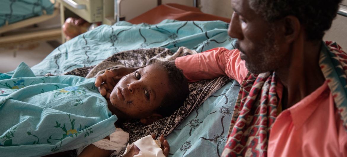 इथियोपिया के टीगरे क्षेत्र में एक ग्रेनेड की चपेट में आने से घायल 10 वर्षीय बच्चे का उपचार किया जा रहा है.