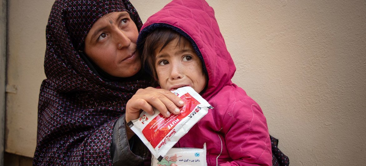 Criança é tratada por desnutrição aguda grave em uma clínica móvel em Herat, no Afeganistão