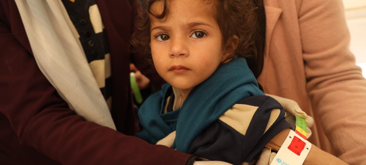 طفلة تبلغ من العمر عامين في غزة تخضع لفحص سوء التغذية.
