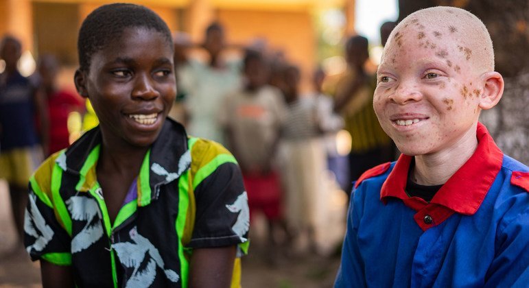 Albinizm Farkındalık Günü münasebetiyle BM’den ‘Kapsayıcılık güçtür’ vurgusu

 Nguncel.com