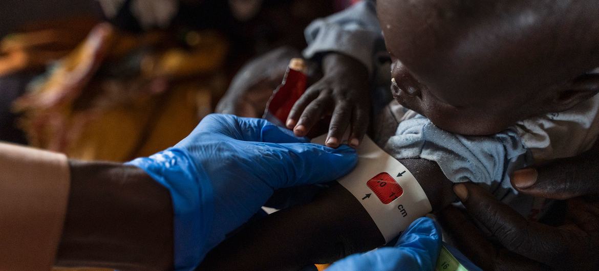 A child is assessed for malnutrition at a health facility in Um Sagour camp in Sudan's White Nile State. 