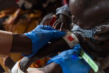 Un enfant est examiné pour malnutrition dans un établissement de santé du camp d'Um Sagour, dans l'État du Nil Blanc au Soudan.