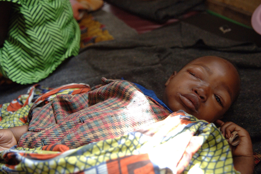 Un niño descansa en un centro de salud asistido por UNICEF en el campamento de desplazados de Kibati, cerca de Goma, capital de la provincia de Kivu del Norte.