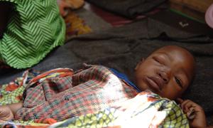 A five-year-old boy suffering from monkeypox rests in a health centre in a displaced camp in North Kivu, Democratic Republic of the Congo. (file)
