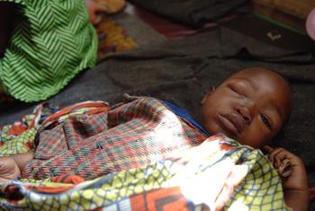 काँगो लोकतांत्रिक गणराज्य (DRC) में विस्थापित लोगों के लिये उत्तर कीवू में बनाए गए एक स्वास्थ्य केन्द्र में, मंकीपॉक्स से संक्रमित एक पाँच वर्षीय बच्चा.