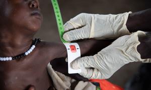 A nutrition worker measures the arm of a severely malnourished baby at a clinic in South Sudan.