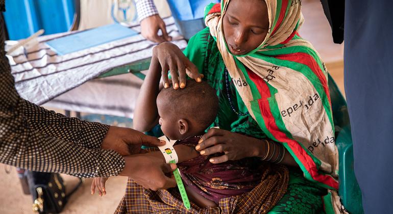 Una niña de un año recibe tratamiento contra la desnutrición en una clínica financiada por el Programa Mundial de Alimentos en Dolow, Somalia.