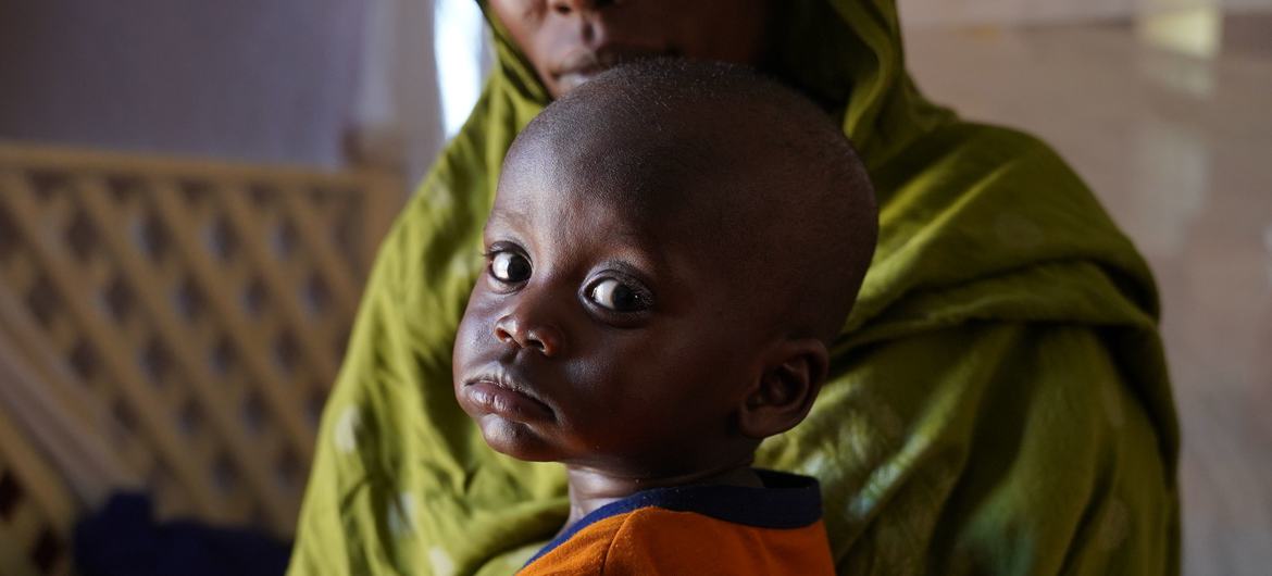 الطفل ماهر أحضرته والدته إلى مركز التغذية في أبوشوك، شمال دارفور، السودان لإجراء فحص صحي.